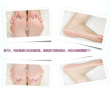 1 Pair Baby Foot Peeling Renewal Exfoliate Mask Remove Dead Skin Prevent Heel UBY