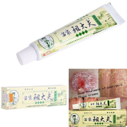 15g Psoriasis Dermatitis Eczema Treatment Anti Bacterial Skin Fungus Herbal Cream Ointment Miao UBY