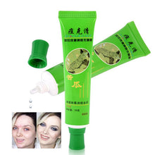 30g Acne Cream Blain Products Desalt Blain To Imprint Face Cream Face Treatment UBY