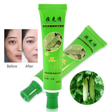 30g Acne Cream Blain Products Desalt Blain To Imprint Face Cream Face Treatment UBY