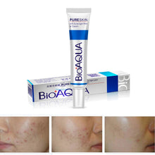30g Aloe Plant Extract Acne Scar Remove Whitening Antibacterial Ointment Face Skin Care Cream UBY