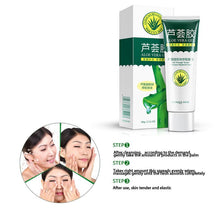 40g Aloe Vera Gel Skin Care After Sun Face Cream Hyaluronic Acid Anti Winkle Whitening Moisturizing Acne Treatment Cream UBY