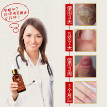 A quality Fungal Nail Treatment Essence Nail and Foot Whitening Toe Nail Fungus Removal Feet Care Nail Gel UBY