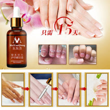 A quality Fungal Nail Treatment Essence Nail and Foot Whitening Toe Nail Fungus Removal Feet Care Nail Gel UBY