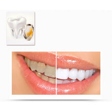 Advanced 3D Ultra White RoutineTeeth Whitening 14 Pairs Strips Dental Bleaching Instrument UBY