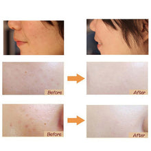 DD Cream Makeup Skin Care  Make UP Korean Cosmetics Whitening Concealer Upgrade BB Cream 30g Maquiagem UBY