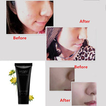 Face Mask Suction Black Head Peel Masks Deep Cleansing Tearing Blackhead Remover Purifying UBY