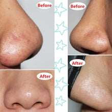 Face Mask Suction Black Head Peel Masks Deep Cleansing Tearing Blackhead Remover Purifying UBY