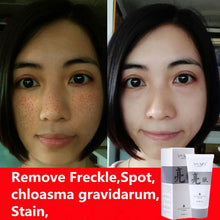 Fade Dark Spots Face Mask Whitening and Spot Removal Productoisturizing Exfoliator Anti Wrinkle Skin Care Masks 40g UBY