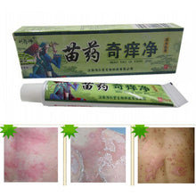 Net Herbal Itch Cream Fungal Infections Foot And Ringworm Balanitis Hemorrhoids Anti-itch Body Creams UBY