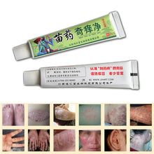 Net Herbal Itch Cream Fungal Infections Foot And Ringworm Balanitis Hemorrhoids Anti-itch Body Creams UBY