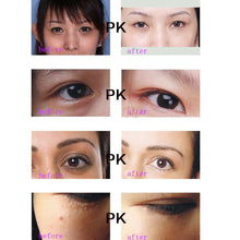 30g Anti-Dark Circle Wrinkle Anti Puffiness Wrinkles Gold Snail Repair Eye Cream UBY