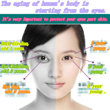 30g Anti-Dark Circle Wrinkle Anti Puffiness Wrinkles Gold Snail Repair Eye Cream UBY