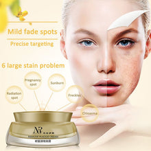 Women Face Skin Whitening Remove Freckle Speckle Peel Dark Spot Wrinkles Cream UBY
