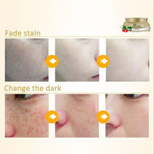 Women Face Skin Whitening Remove Freckle Speckle Peel Dark Spot Wrinkles Cream UBY