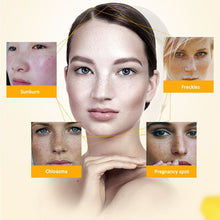 Women Face Skin Whitening Remove Freckle Speckle Peel Dark Spot Wrinkles Cream UBY
