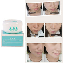 Powerful whitening Freckle cream Remove melasma Acne Spots pigment Melanin face care cream L4 UBY